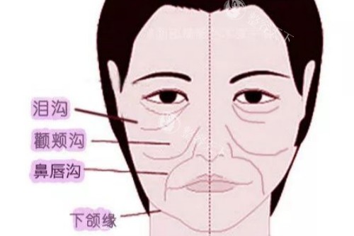 深入分析:Emface和热玛吉区别是什么?Emface价格多少钱?