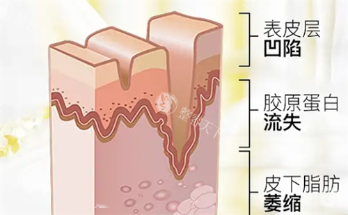 好奇湖州安吉管愿愿医疗美容怎么样？看过来，真实反馈大揭秘！
