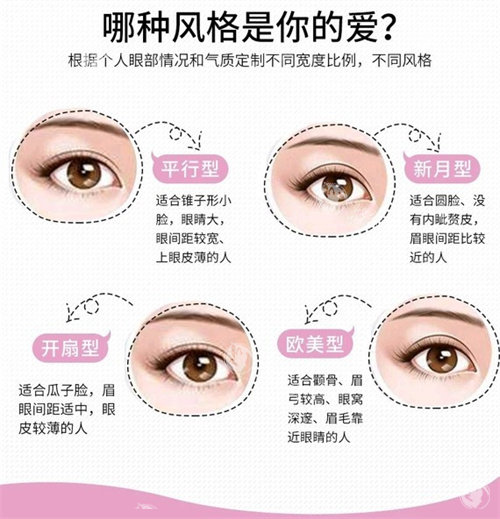 珠海双眼皮医生大揭秘：张晓纯、王彪等四位医生技术优势全公开​