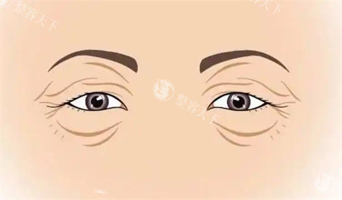 唐山华中医疗美容医院怎么样？双眼皮自然无痕+隆鼻修复显要，连锁品牌打造定制化眼鼻精细雕刻！