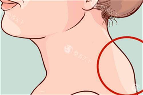 惊呆了！黄学锋消除富贵包价格大揭秘，看完不纠结！还有医院详情大公开！