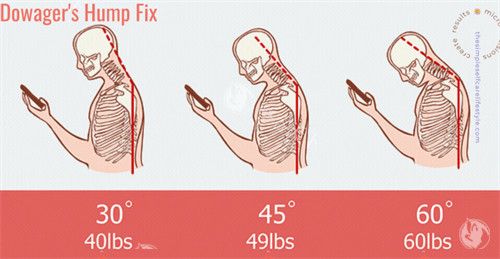 震惊！黄学锋消除富贵包是真的吗？患者亲述体验，真相大揭秘！