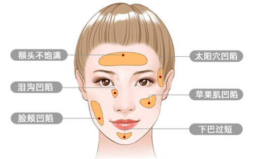 北京本爱医疗美容怎么样？看脂肪移植这篇包含实例和评价的深入分析！