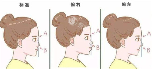 重庆吴松隆鼻怎么样​？不仅技术娴熟且性价比较高！