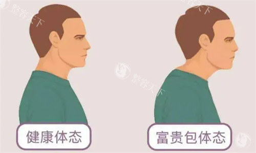 北京富贵包手术多少钱？价格在3000-8000元起不等！需结合手术类型、病情复杂程度、医院等决定~