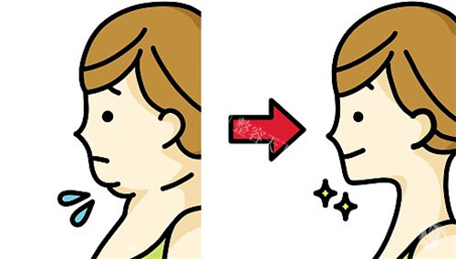 男性抗衰专属方案！“射频微针+下颌缘提升”如何解决“发腮+双下巴”？