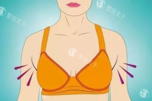 为什么越来越多女性选择副乳切除？这5大优势让你不再犹豫