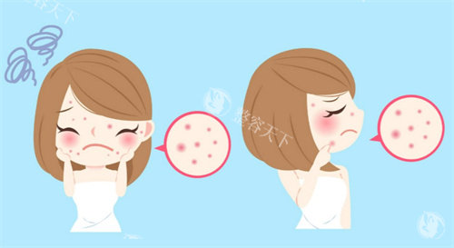 午休式抗衰新选择！“超脉冲CO2点阵激光”如何实现15分钟焕肤？上班族下班秒变“素颜女神”