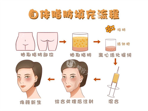 南阳芘丽芙时光医院医生介绍：郭帅|蒋小花|程文明|徐翔医生擅长项目在线查询