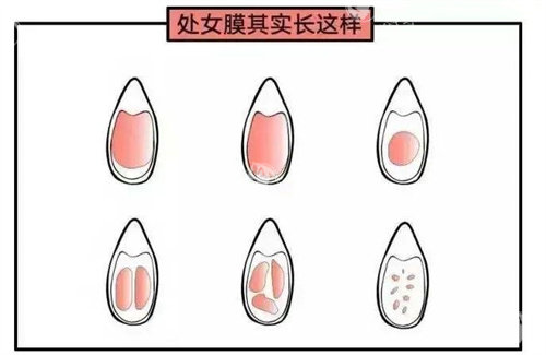 南宁处女膜修复医院怎么选？对比5家机构价格/技术/隐私保护，看完再决定！