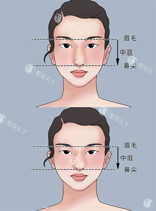 上海伯思立医疗美容价格一览：眼鼻整形、吸脂、隆胸、拉皮项目费用全公开！