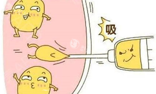 王东吸脂技术怎么样​？会综合考虑大腿和臀部的脂肪分布，确定吸脂范围和吸脂量