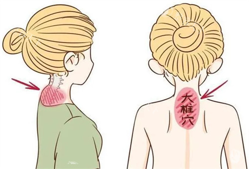 泉州亿星医疗美容正规吗?口碑怎么样?郑伟艺医生做耳朵整形/异物取出/富贵包等项目技术好！