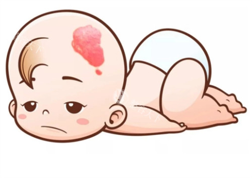 点痣去医院挂哪个科室？皮肤科或医疗美容科，附在线挂号预约方式！