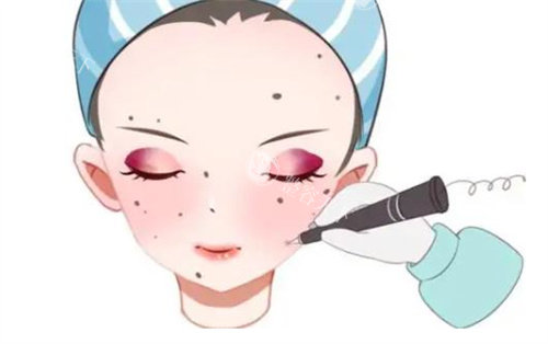 点痣去医院挂哪个科室？皮肤科或医疗美容科，附在线挂号预约方式！