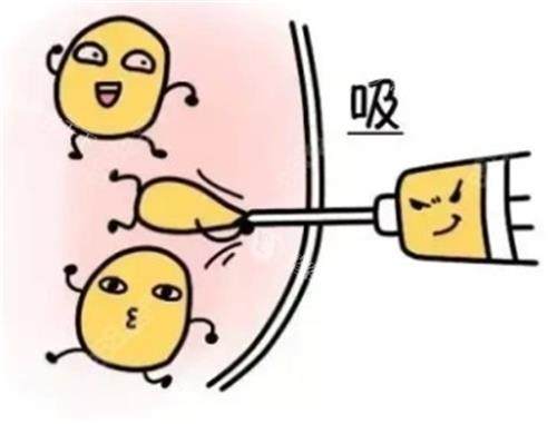 上海吸脂手术多少钱？2025价格表：面部局部吸脂3000元起/腰腹12000元起/大腿10000元起！