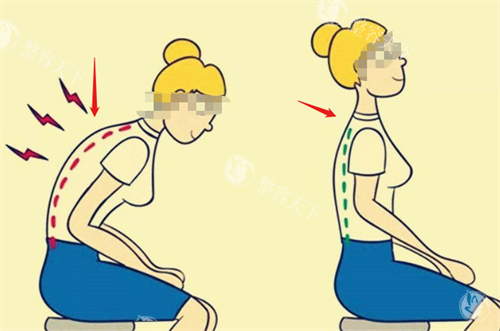 如何选择富贵包去除方案？吸脂、射频、手术哪种更适合你？