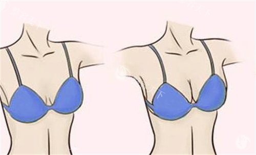 贵阳首美思君医疗美容怎么样?揭秘热门整形项目和医院简介介绍，收费合理别错过！