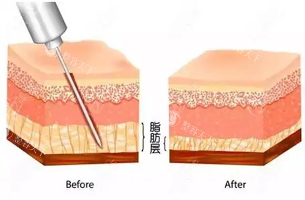 贵阳首美思君医疗美容怎么样?揭秘热门整形项目和医院简介介绍，收费合理别错过！