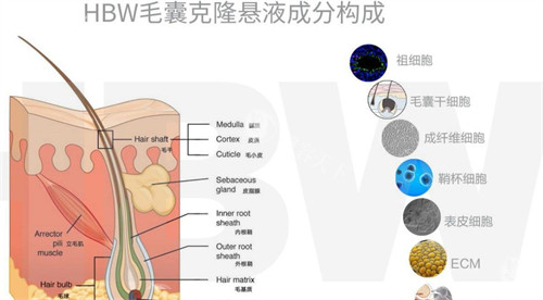 广州哪家医院能做hbw毛囊克隆植发？广州大麦微针植发医院在毛囊克隆植发方面表现出色，技术靠前、服务周到