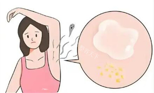 想了解2025狐臭手术多少钱？不同类型、人群、城市的价格明细都在这儿啦！