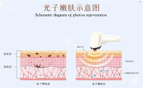 淮安艺后医疗美容整形特点公开，双眼皮/隆鼻/假体隆胸口碑好都受欢迎！