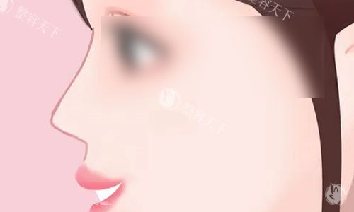 想了解成都后美医疗美容医院做鼻子的实力？专科医生团队 + 优质服务，助您拥有理想鼻型！