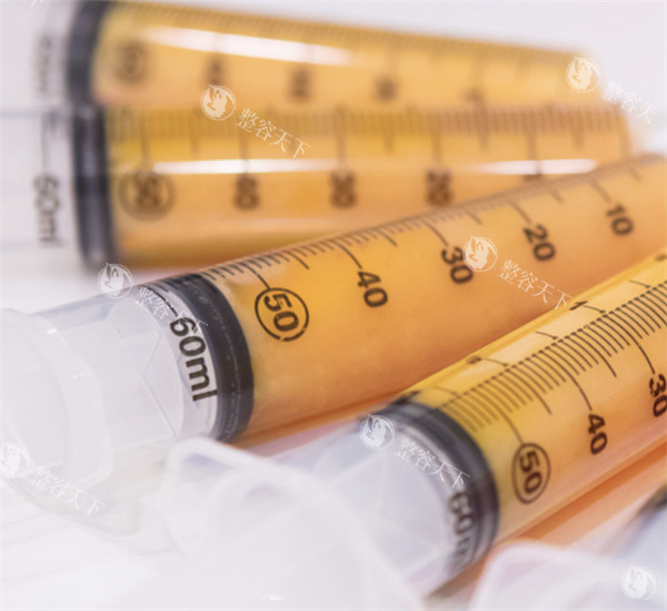 纳米脂肪vs自体脂肪区别解析：存活率提升40%！精细填充泪沟/皱纹更佳~