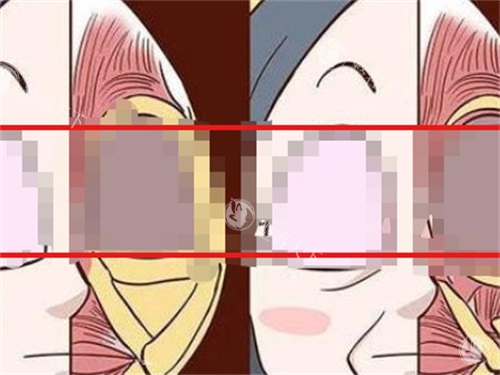 深圳打玻尿酸哪家医院好?八大处整形/美莱整形资质正规,乔雅登5800元起,预约享优惠