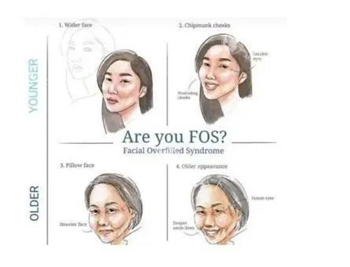 馒化脸较好的修复方法?别急,这3个真实病例里藏着关键答案!