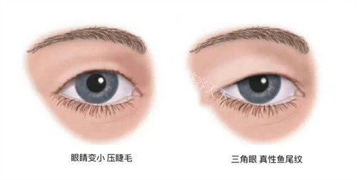 重庆鹏爱王琪斌医生评价，手术费用透明合理、技艺娴熟！