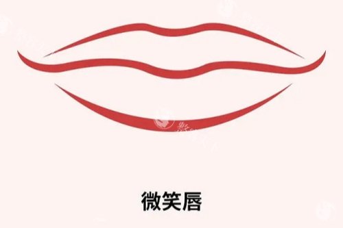 微笑唇整形手术多少钱？2025价格解析+避坑指南，一篇看懂！