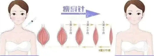 2025东莞晗悦整形价格表曝光，涵盖眼、鼻、胸、吸脂、注射等热门项目