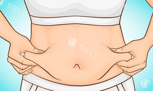 苏州腰腹环吸手术价格全解析！吸脂5斤和10斤收费居然差这么多？