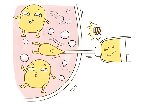 深圳阳光刘明飞整形医生抽脂怎么样？5G光雕术创伤小速度快|术后2天上班+腿围直减6cm病例分享
