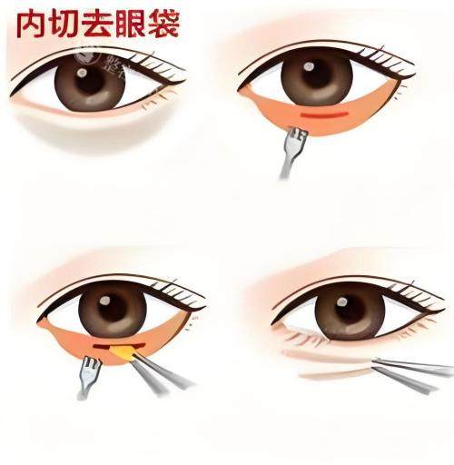 玉林时光整形医院医生名单查询：含龙涛/李红梅/陈鸿/于海生拿手项目解析