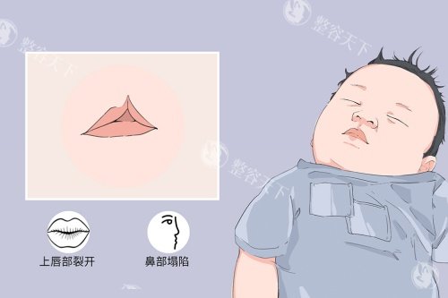医院唇腭裂挂什么科室?别犹豫啦!直接唇腭裂正畸专科门诊,靠谱修复口碑好!