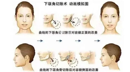 韩国整形医院排名前三的是哪几家？想去韩国做整形的小伙伴一定要收藏这份榜单！