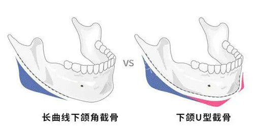 湖州浙美医疗美容靠谱吗？评分和口碑咋样？附近交通路线及项目价格一览！
