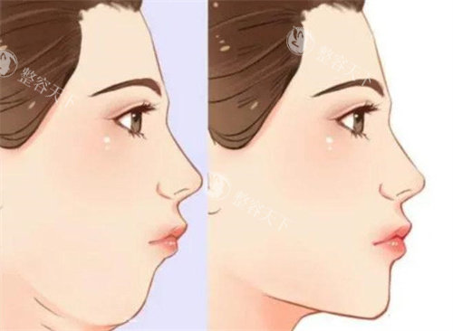 湖州长兴悦美医疗美容正规吗？资质齐全吗？真实顾客分享术后结果和预约攻略！