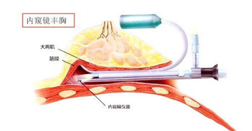 成都出彩医美靠谱吗？探店实拍+真实术例分享，看完再决定要不要去！