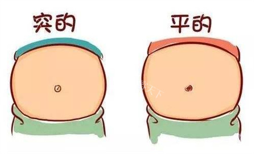 肚脐整形图片前后对比：专科医生解析3种常见术式，打造理想肚脐的秘诀！