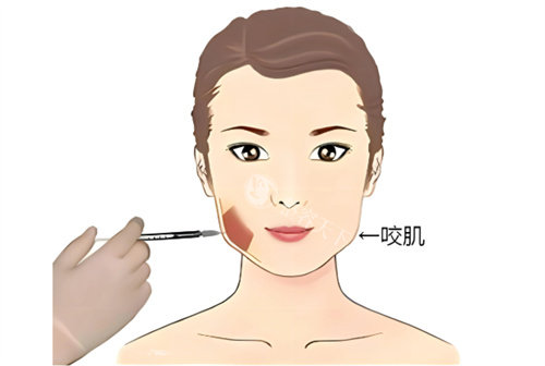 成都普罗普姿原韩整形技术好吗？韩国院长坐镇+真实术例分享，变漂亮必看攻略！
