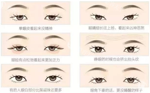 刘志刚眼修复真实结果解析，正规眼修复技术的特点与优势