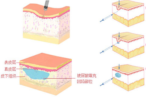 上海偶索医疗美容怎么样？真实用户口碑+耀体路308号探店测评