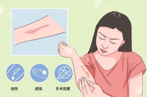 南宁首大疤痕修复医院怎么样？SRT抗复发系统攻克增生难题，环境/服务与收费透明度成医院亮点！