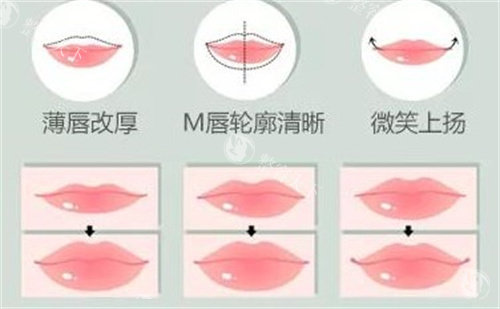 马群医生在哪家医院做唇部整形？在北京画美可联系到他，附预约挂号方式