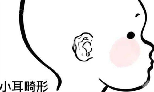 孩子耳畸形家长愁？余文林医生一招搞定，快来了解神奇修复术！