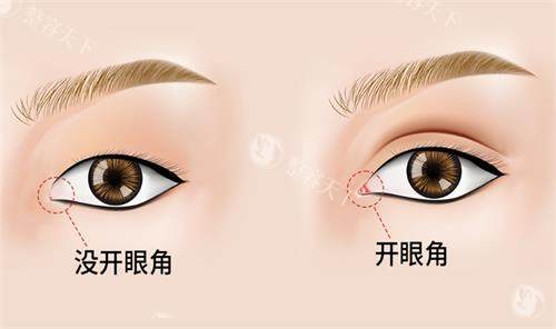 长沙珀斐杨琪医生做眼部整形怎么样？技术很成熟审美很自然！