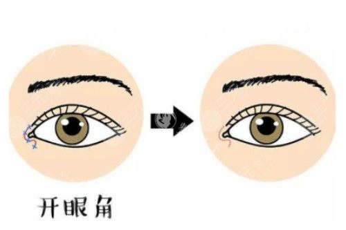 长沙珀斐杨琪医生做眼部整形怎么样？技术很成熟审美很自然！